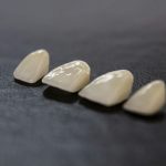 a group of white stones